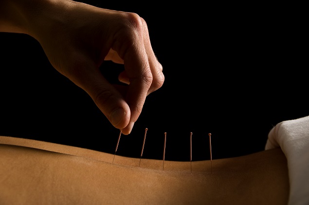 acupuntura